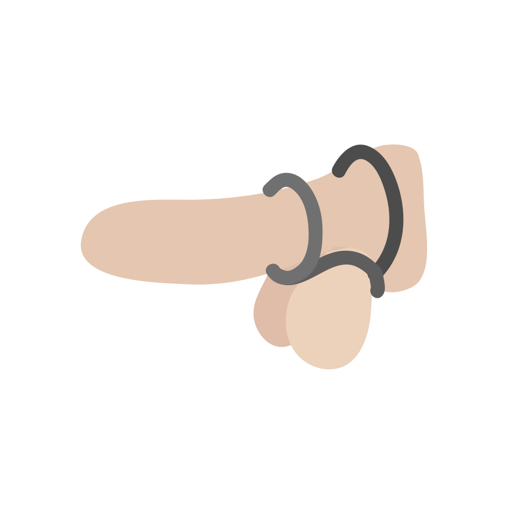 Anilla estranguladora Ula de Platanomelón